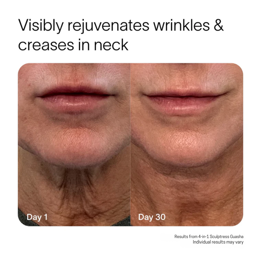 Nature's Fix™- The Sculptress 3.0